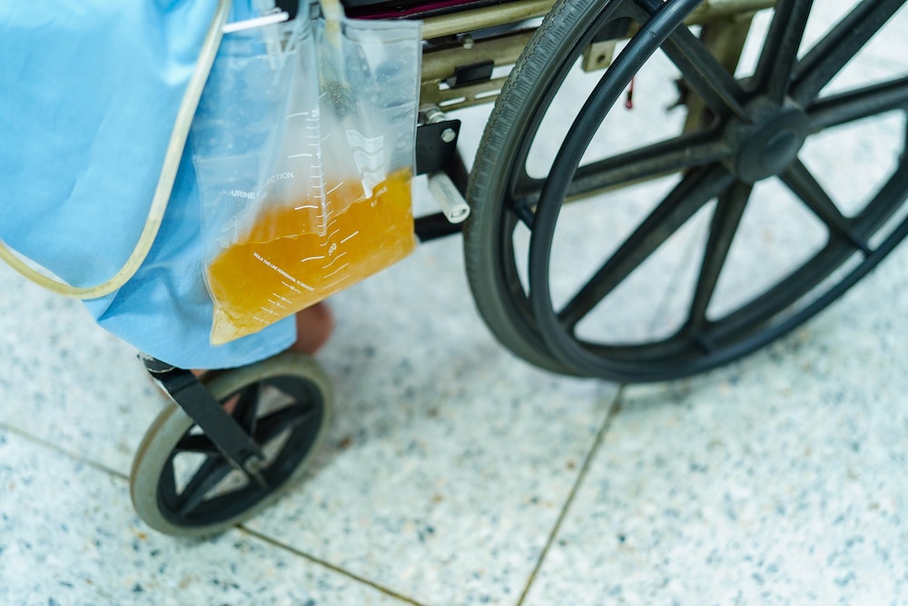 Comment maximiser les profits dans le business des poches urinaires